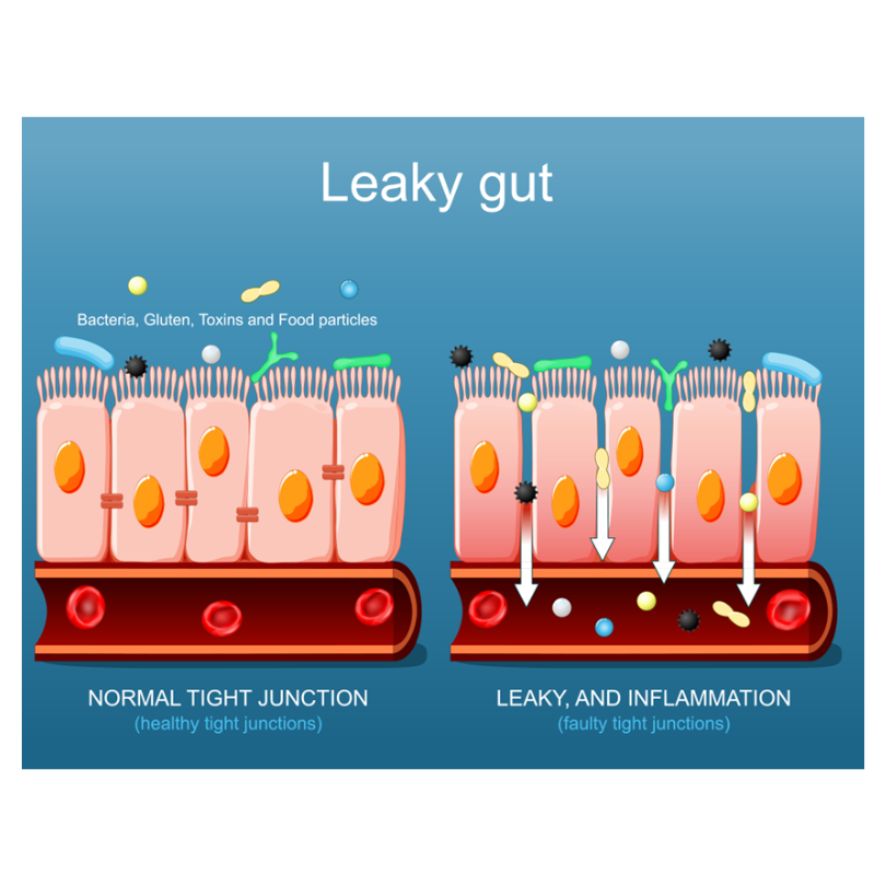 Leaky Gut