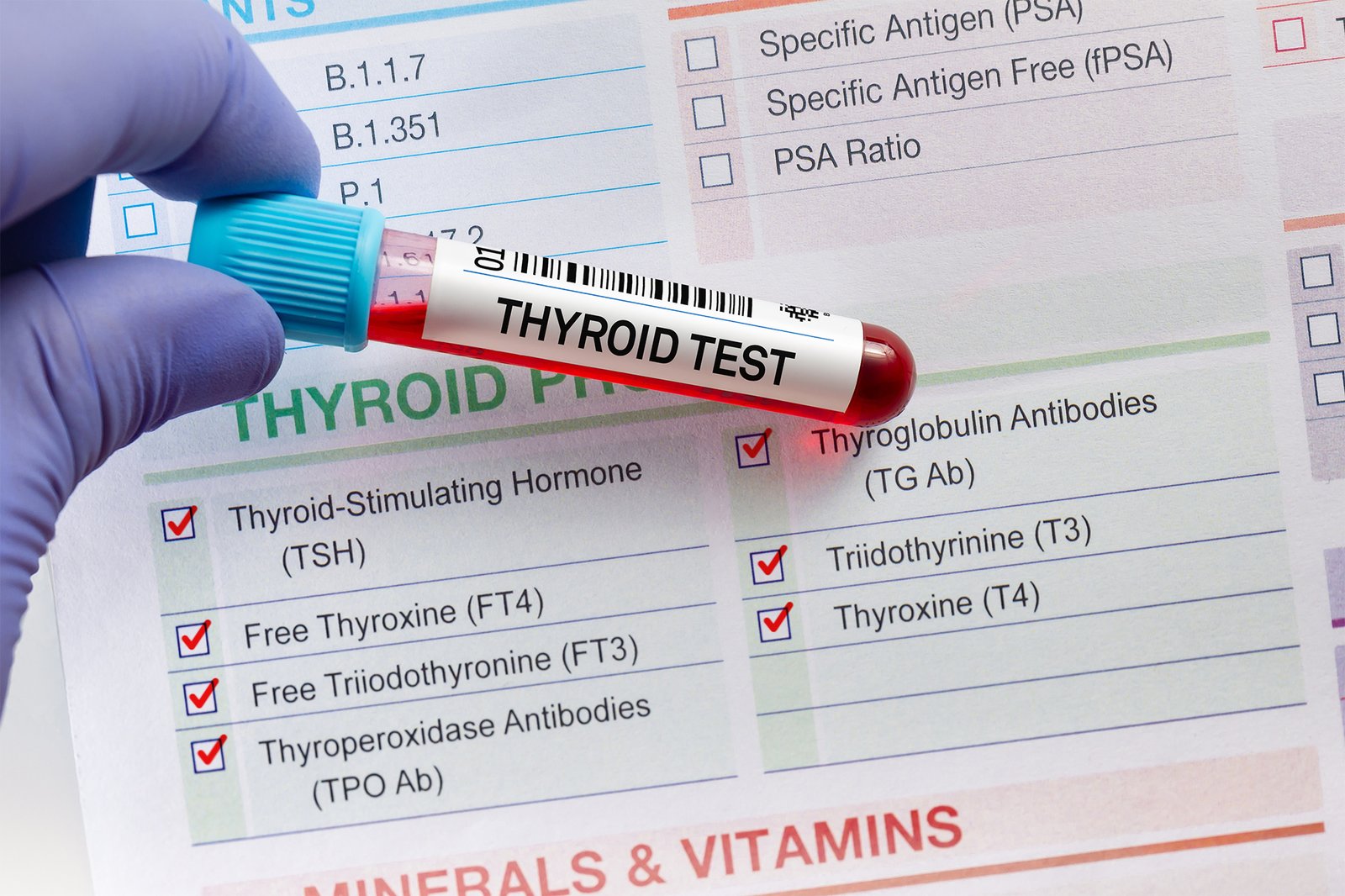 Thyroid Testing