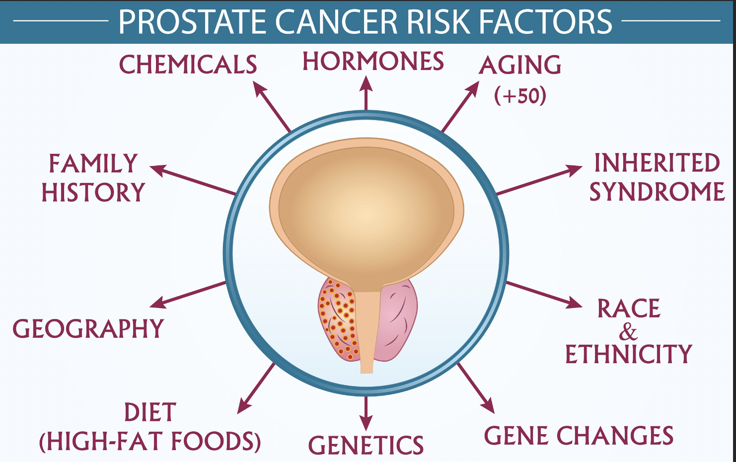 Prostate Cancer Risk Factors